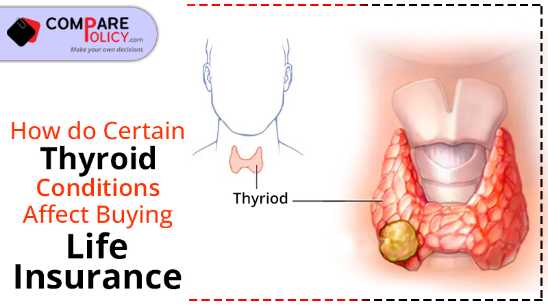 How do certain thyroid conditions affect buying life insurance